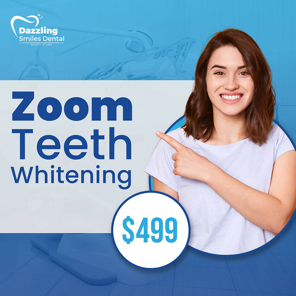 Zoom Teeth Whitening in Lara, dentist in Lara